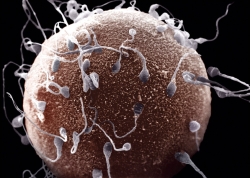 miért van kevés spermium az erekció során