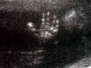 2D UH testrészek